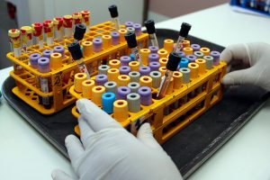 Minsal hantavirus