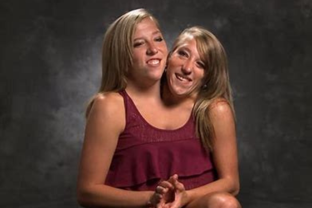 Abby Brittany Hensel