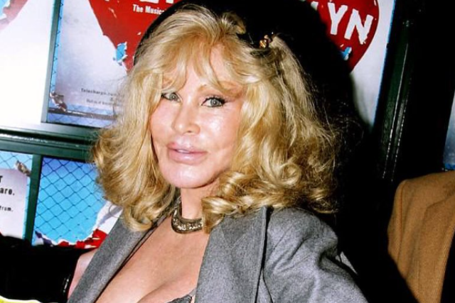 Jocelyn Wildenstein mujer gato