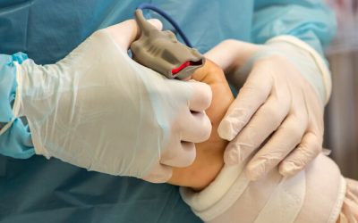 Vasectomía en Chile: En la última década han aumentado un 500%