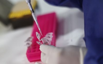 Conozca los síntomas y cómo se contagia la viruela del mono