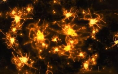 Alzheimer
