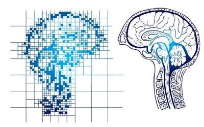 Cerebro