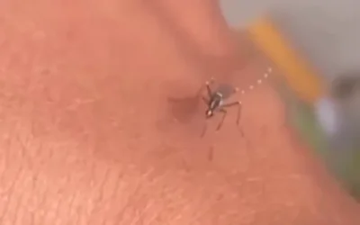 Malaria