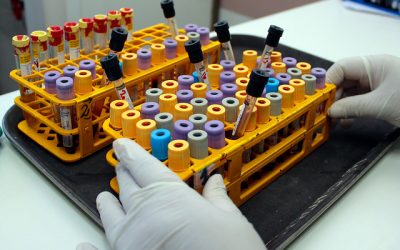 Minsal hantavirus