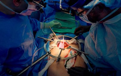 Estados Unidos documenta riñón de cerdo en cuerpo humano